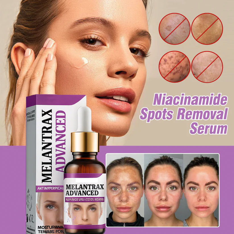 10% Niacinamide Spots Removal Serum 🎉Second Item half price🎉