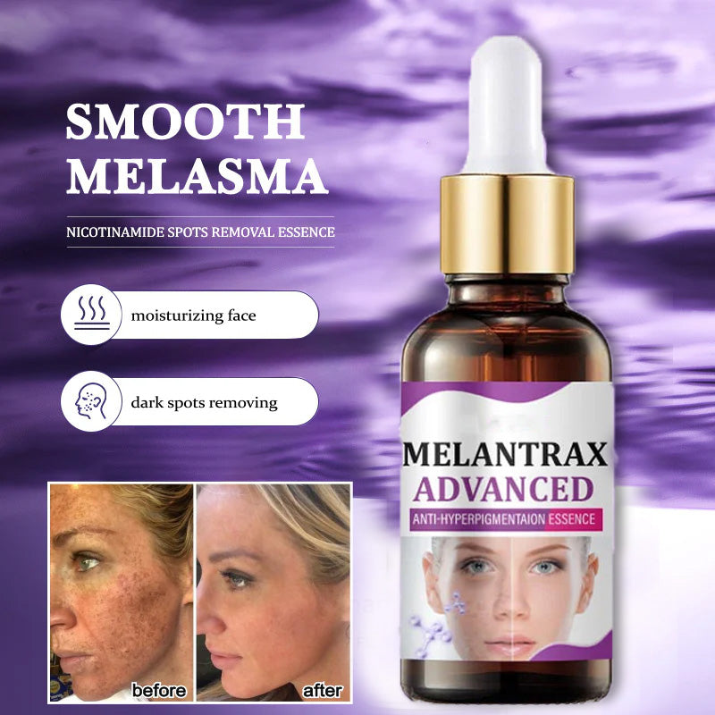 10% Niacinamide Spots Removal Serum 🎉Second Item half price🎉