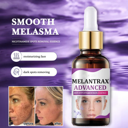 10% Niacinamide Spots Removal Serum 🎉Second Item half price🎉