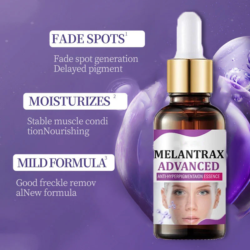 10% Niacinamide Spots Removal Serum 🎉Second Item half price🎉