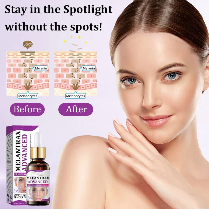 10% Niacinamide Spots Removal Serum 🎉Second Item half price🎉